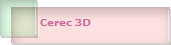 Cerec 3D